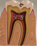 dis_curuk_karsiyaka_dental